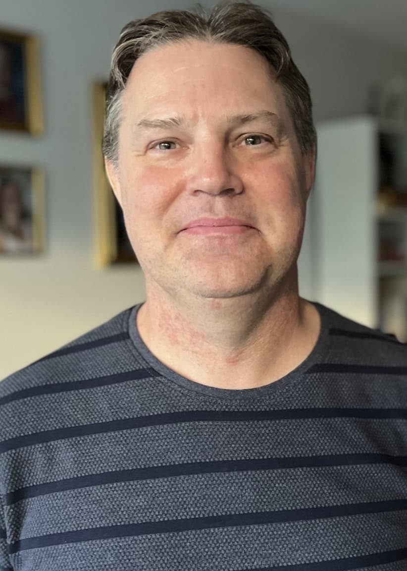 Stefan Svallhed står i ett vardagsrum med randig tröja. Han har genomgått två levertransplantationer och är idag smärtfri. I bakgrunden syns möbler, lampor och fotografier på väggen.
