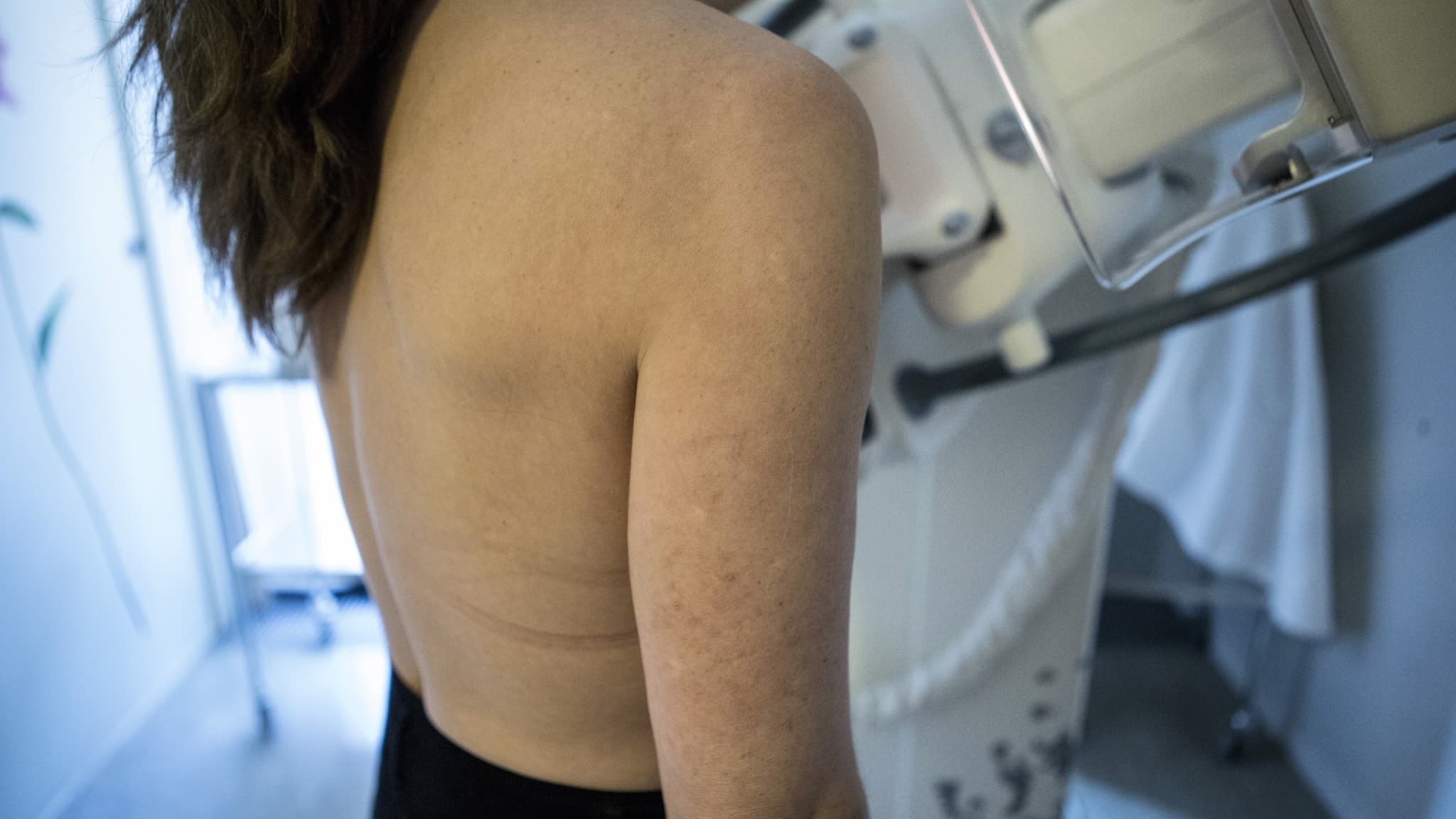 en kvinna får sina bröst undersökta för bröstcancer i en röntgenapparat
